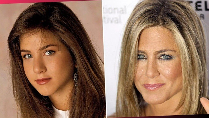 Jennifer Aniston Plastic Surgery Before And After
